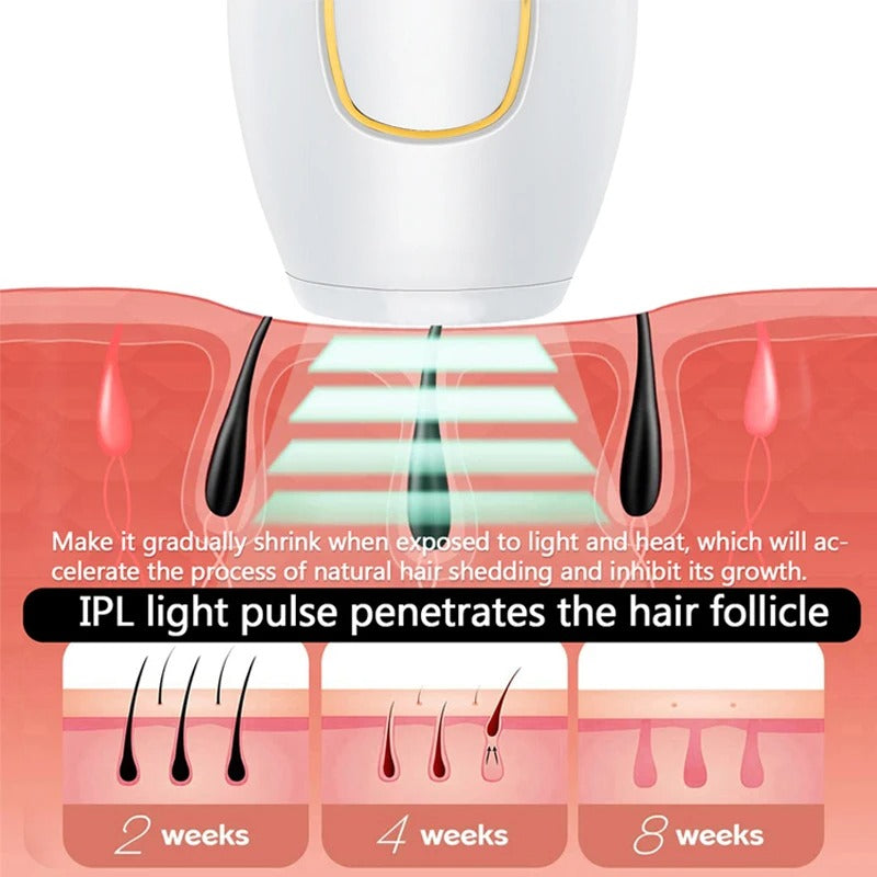 Depiladora IPL laser